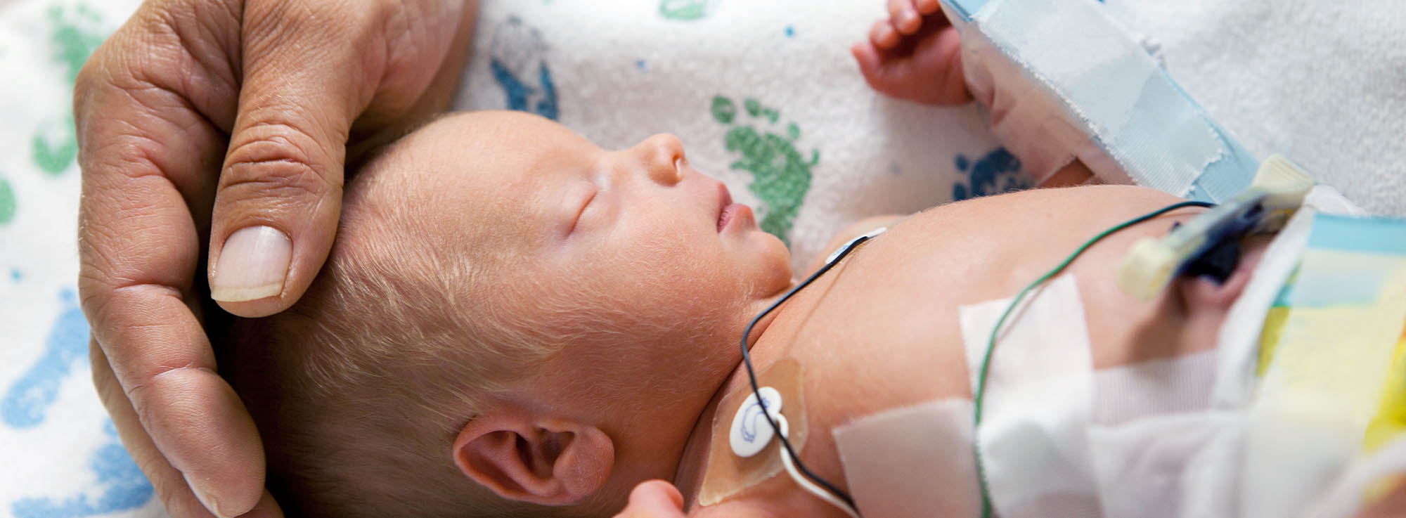 World Prematurity Day 2021